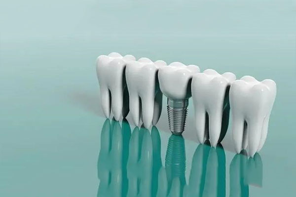 乳牙滞留是指的什么原因(乳牙滞留是啥意思)