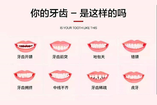 上下牙咬合对不齐怎么回事(上下牙咬