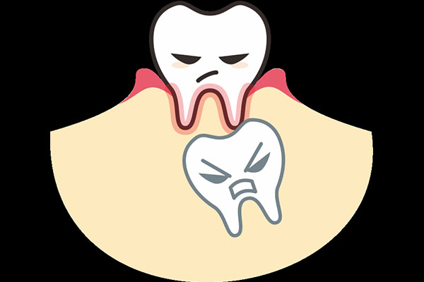 乳牙滞留医生不建议拔空了(乳牙滞留医生不建议拔空了怎么回事)