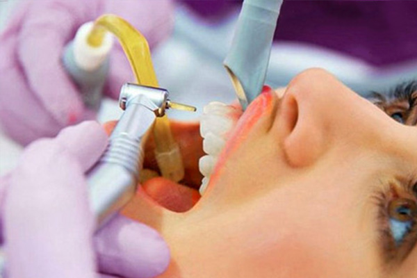 牙齿缺损修补技术修复多少钱一颗(牙齿缺损修补技术修复多少钱一颗呢)