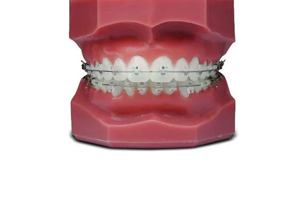 成品树脂排水沟多少钱一米300×500雨水篦子多少钱米(树脂排水沟尺寸)