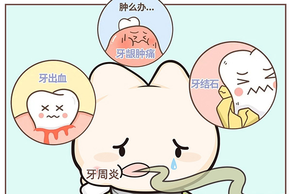 严重牙周炎的症状有哪些(严重牙周炎