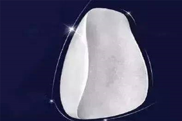 16颗牙齿贴面价格多少(16颗牙齿贴面价