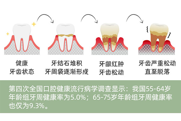 中医治疗牙周炎的有效方法有哪些(中医治疗牙周炎的有效方法有