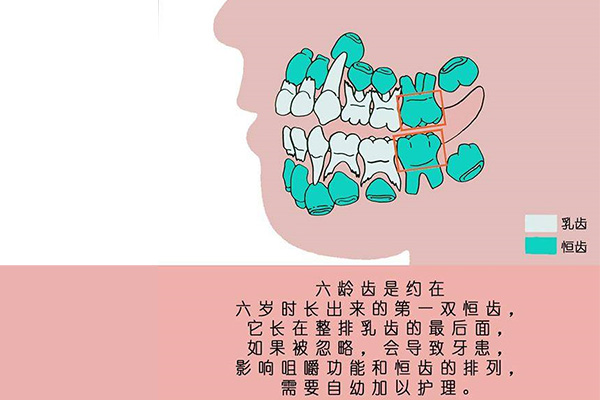10岁孩子六龄牙坏了怎么办呀吃什么药
