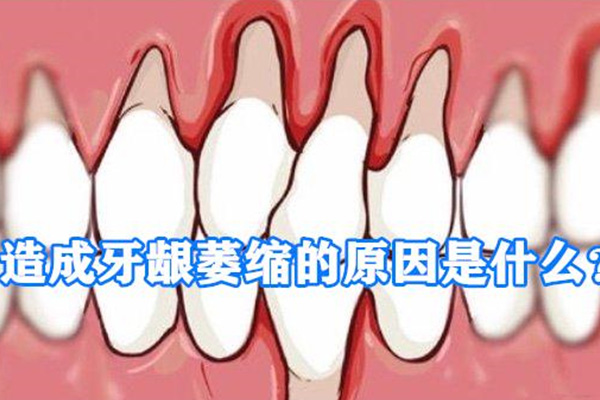20多岁牙龈萎缩严重怎么办呀(20多岁牙