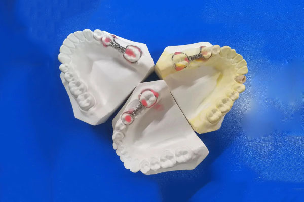 活动假牙使用注意事项有哪些呢(活动假牙使用注意事项有哪些呢视频)