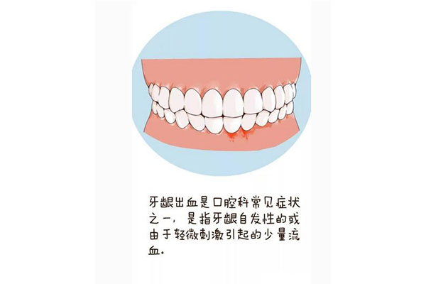 一啃苹果牙就出血(一啃苹果牙就出血怎么办)