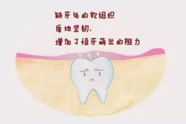 上牙最后面牙龈上长了一个小牙是什么(上牙最后面牙龈上长了一