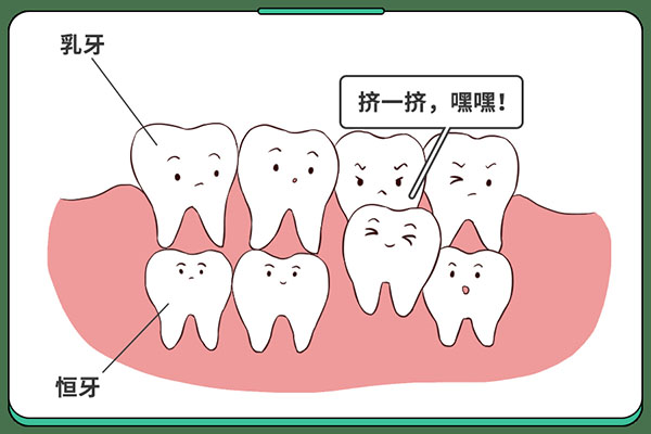 乳牙滞留恒牙长出来了(乳牙滞留恒牙