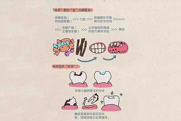 12岁小孩蛀牙了怎么办呀吃什么药(12岁小孩蛀牙了怎么办呀吃什