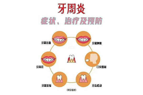 严重牙周炎导致牙齿全部松动是身体