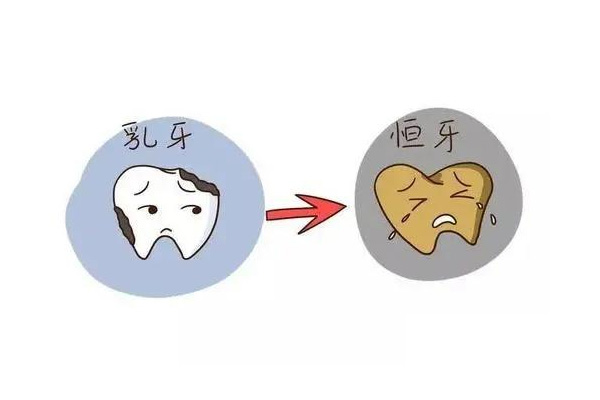 乳牙滞留恒牙萌出受阻的原因(乳牙滞