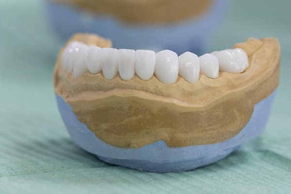 卡瑞斯玛树脂优点(卡瑞斯玛树脂优缺点)