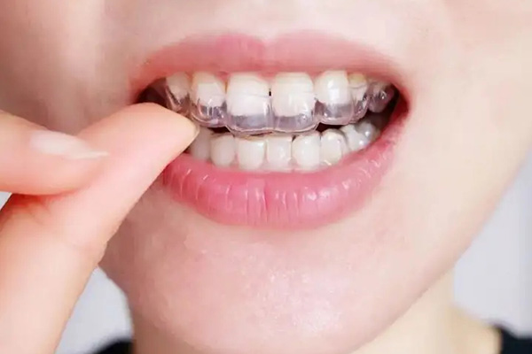 不龅牙但凸嘴问题严重(我不龅牙为什么嘴巴还鼓起来)
