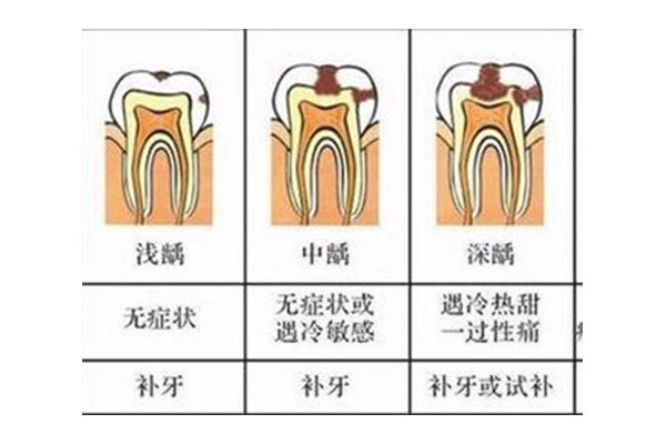 20多岁蛀牙太多怎么办,老了怎么办(20多岁蛀牙太多怎么办,老了怎