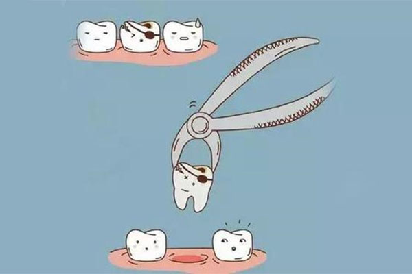 2020年种植牙一颗多少钱(2020年种植牙多少钱一个)