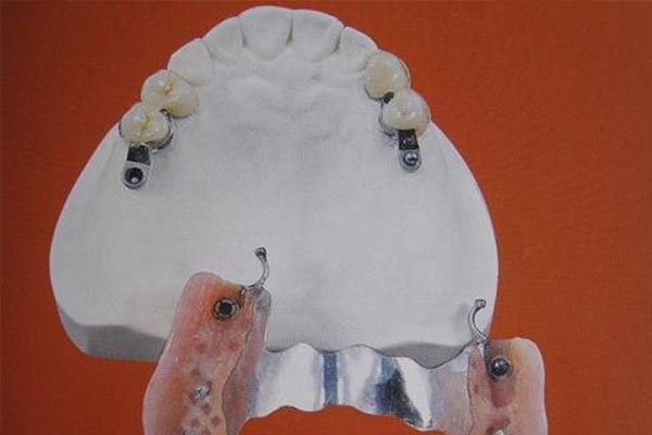 成品树脂u型排水沟尺寸标准(成品树脂u型排水沟尺寸标准是多少)