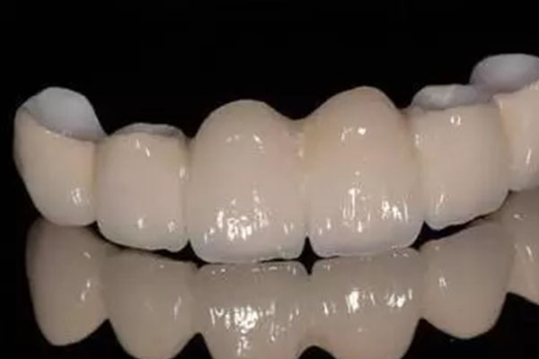 做了牙齿贴面后为什么会牙痛(做了牙