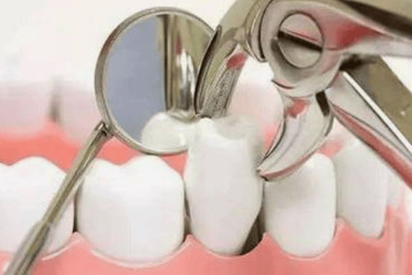 2020年种植牙的价格(2020年种植牙的价格是多少钱)