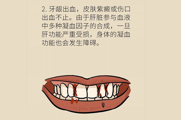 一吃苹果牙龈就出血怎么办(一吃苹果