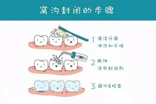 儿童防牙齿蛀虫涂氟好吗(儿童防牙齿蛀虫涂氟好吗图片)