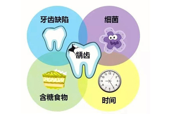 12岁龋齿怎么治(12岁龋齿怎么治疗最好