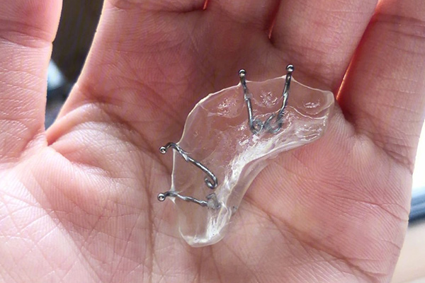 松风树脂好吗(松风树脂好吗有毒吗)