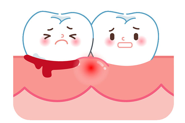 一刷牙就出血是怎么回事女性吃什么药