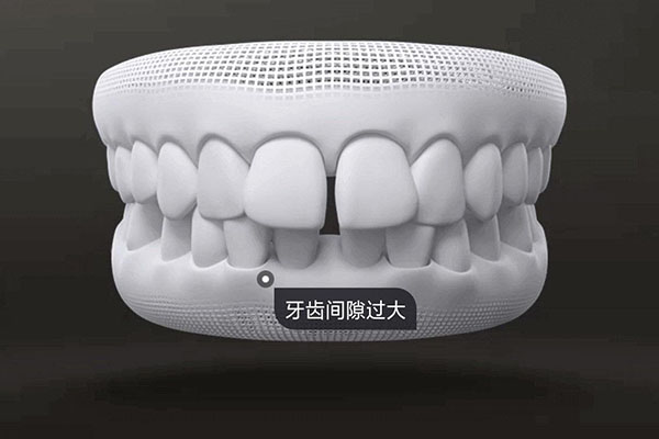 小孩牙齿很稀疏怎么回事(小孩牙齿很