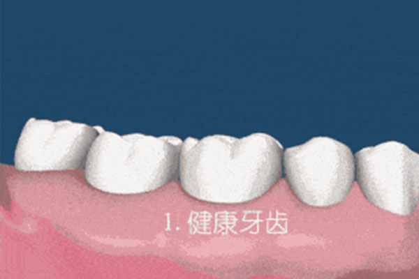 乳牙滞留拔出多少钱一次(乳牙滞留拔出多少钱一次图片)