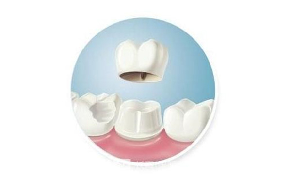 2023年补牙纳入医保了吗北京市(补牙补贴 北京)