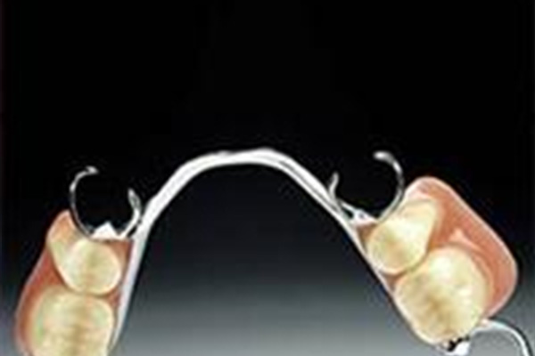 活动假牙 种类(活动假牙种类图片)