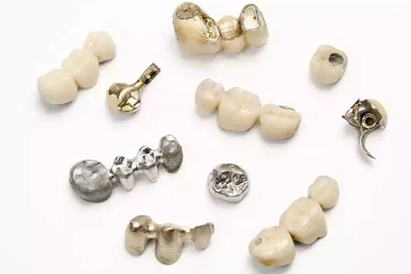 一颗牙冠费用多少钱合适(一颗牙冠需要多少钱)