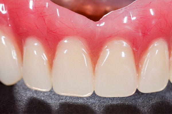 上海义齿加工厂排名前100名有哪些厂(上海义齿加工厂排名前100名有哪些厂)