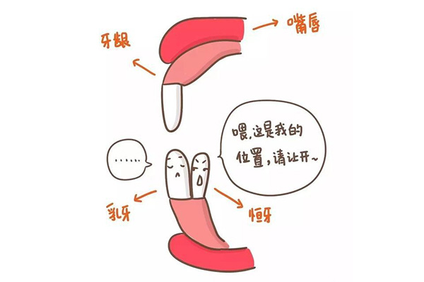 乳牙滞留临床表现包括哪些方面(乳牙