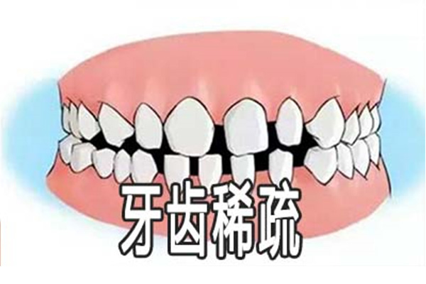 牙缝稀疏怎么解决最有效的方法(牙缝稀疏怎么解决最有效的方法