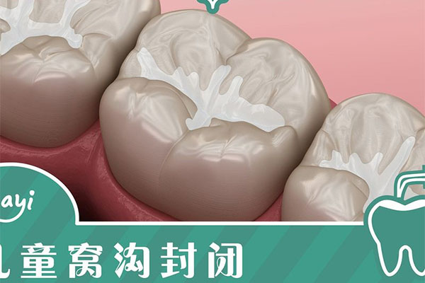 儿童涂氟的步骤包括什么(儿童涂氟的