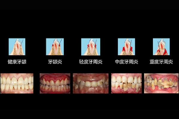 上海看牙周病排前十的医院(上海看牙