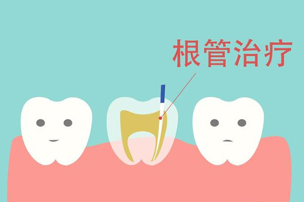 上6的根管名称(上六的根管分别是什么