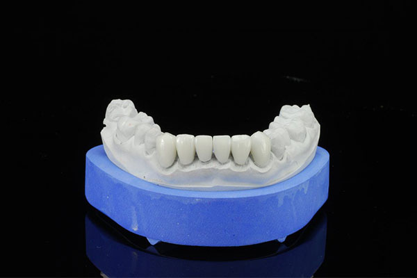 活动假牙一直戴着可以吗(活动牙好还是固定牙好)