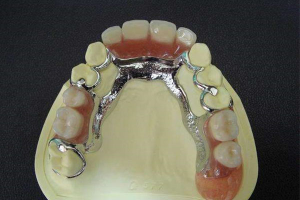 上海义齿加工厂哪家好些啊(上海义齿加工厂哪家好些啊知乎)