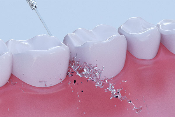 一般洗牙多少时间完成(一般洗牙多少时间完成好)