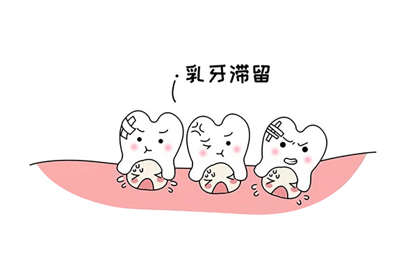 乳牙滞留怎么治疗效果好呢(乳牙滞留怎么治疗效果好呢视频)
