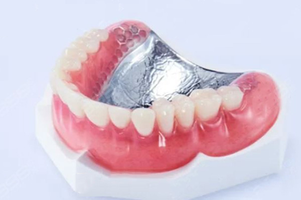 上海义齿加工厂怎么样啊多少钱(上海义齿加工厂怎么样啊多少钱一颗)