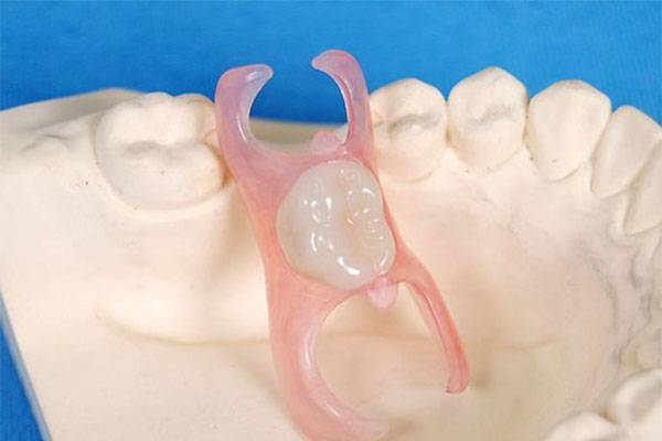 彩钢瓦与树脂瓦哪个好(房顶哪种瓦最耐用)