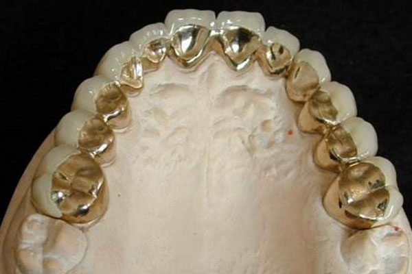 上海三岛义齿技术有限公司上下班时间(上海三岛义齿技术有限公司上下班时间