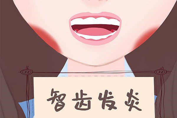 一般几岁长智齿正常(一般几岁长智齿