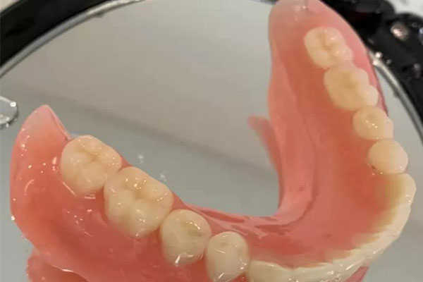 活动假牙的牙托种类(活动假牙的牙托哪种好)