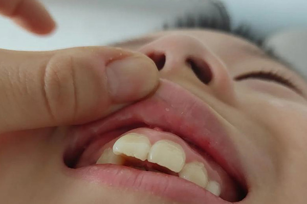 为什么贵州女生都是龅牙(为什么贵州